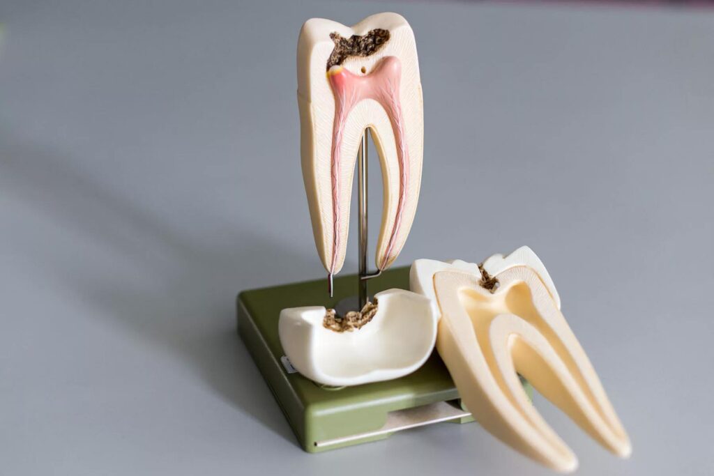 tooth cut in half
