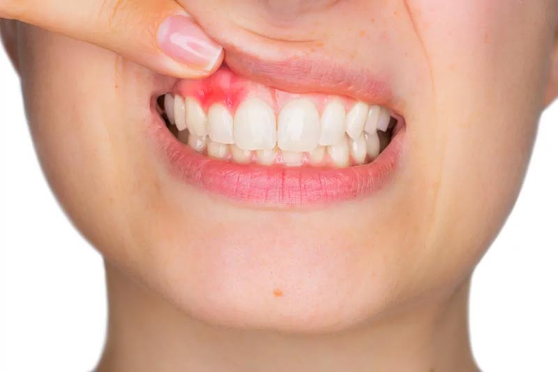 Gum tooth ache
