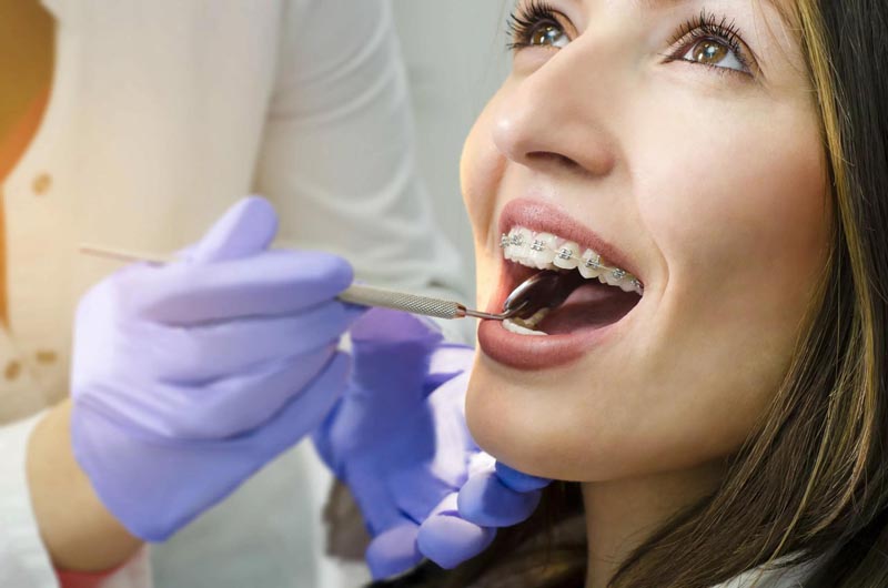 Woman getting her braces checked by a dentist