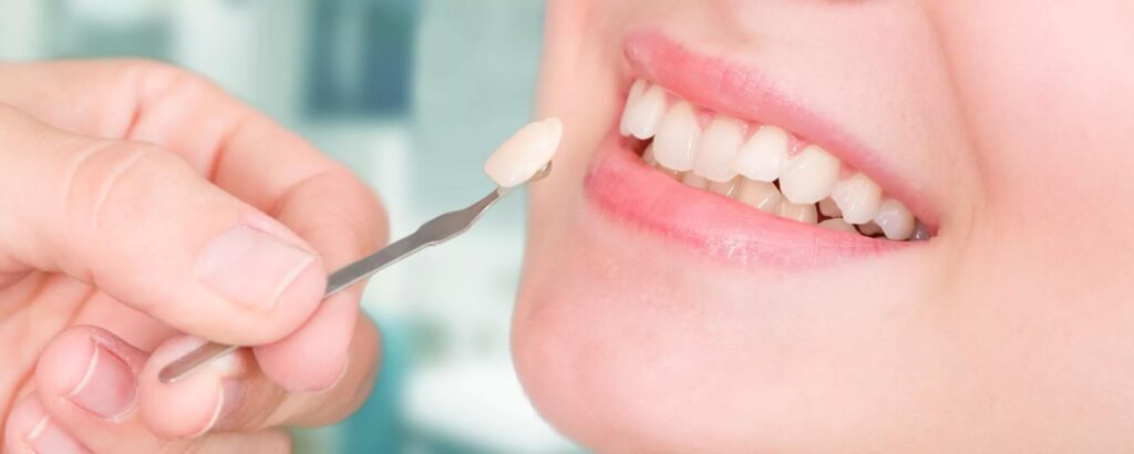 women's teeth and doctor holding cotton