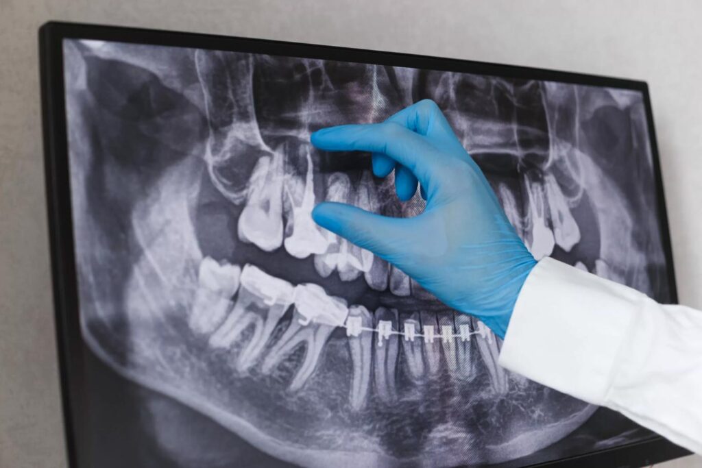 Doctor checking dental X ray
