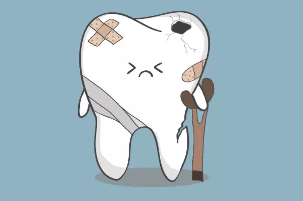 cavities