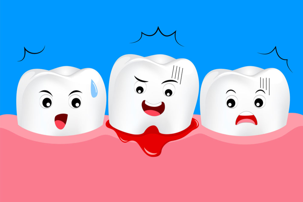 gums bleed