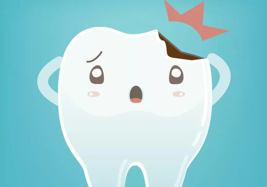 chipped tooth