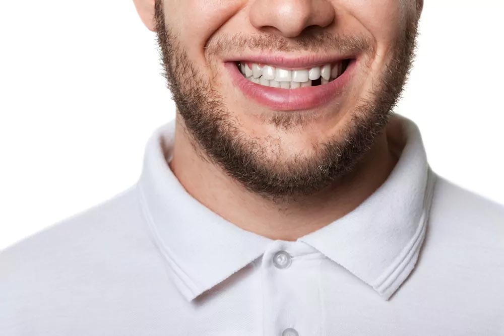 A man showing teeth