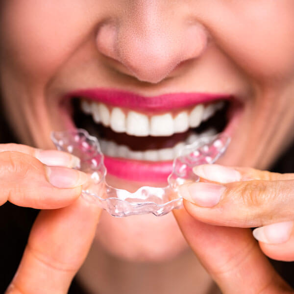 close up of a woman putting in transparent aligners